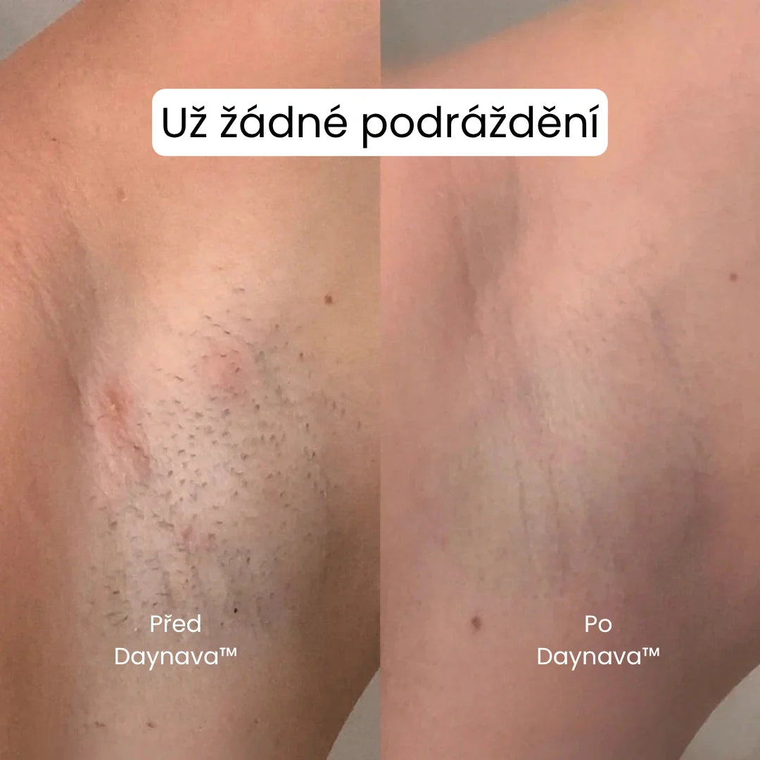 Daynava™ 5v1 Elektrický Holicí Strojek