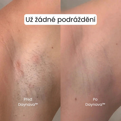 Daynava™ 5v1 Elektrický Holicí Strojek