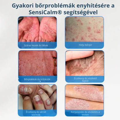 Nyugtató krém fejbőrre és bőrre