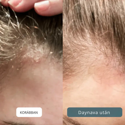 Nyugtató krém fejbőrre és bőrre