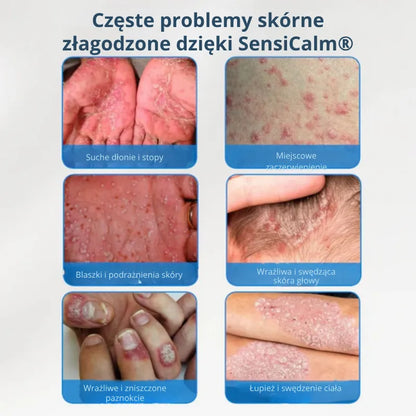 Kojący krem do skóry głowy i skóry