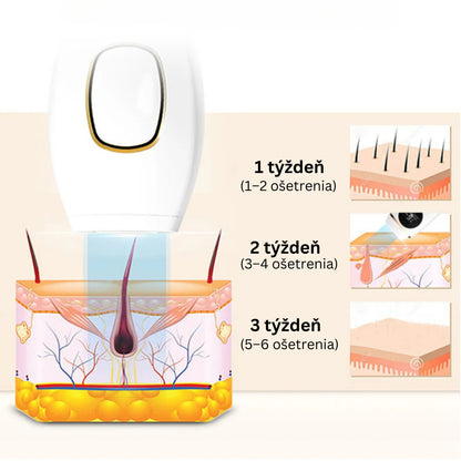 Daynava™ IPL Epilator (SK)