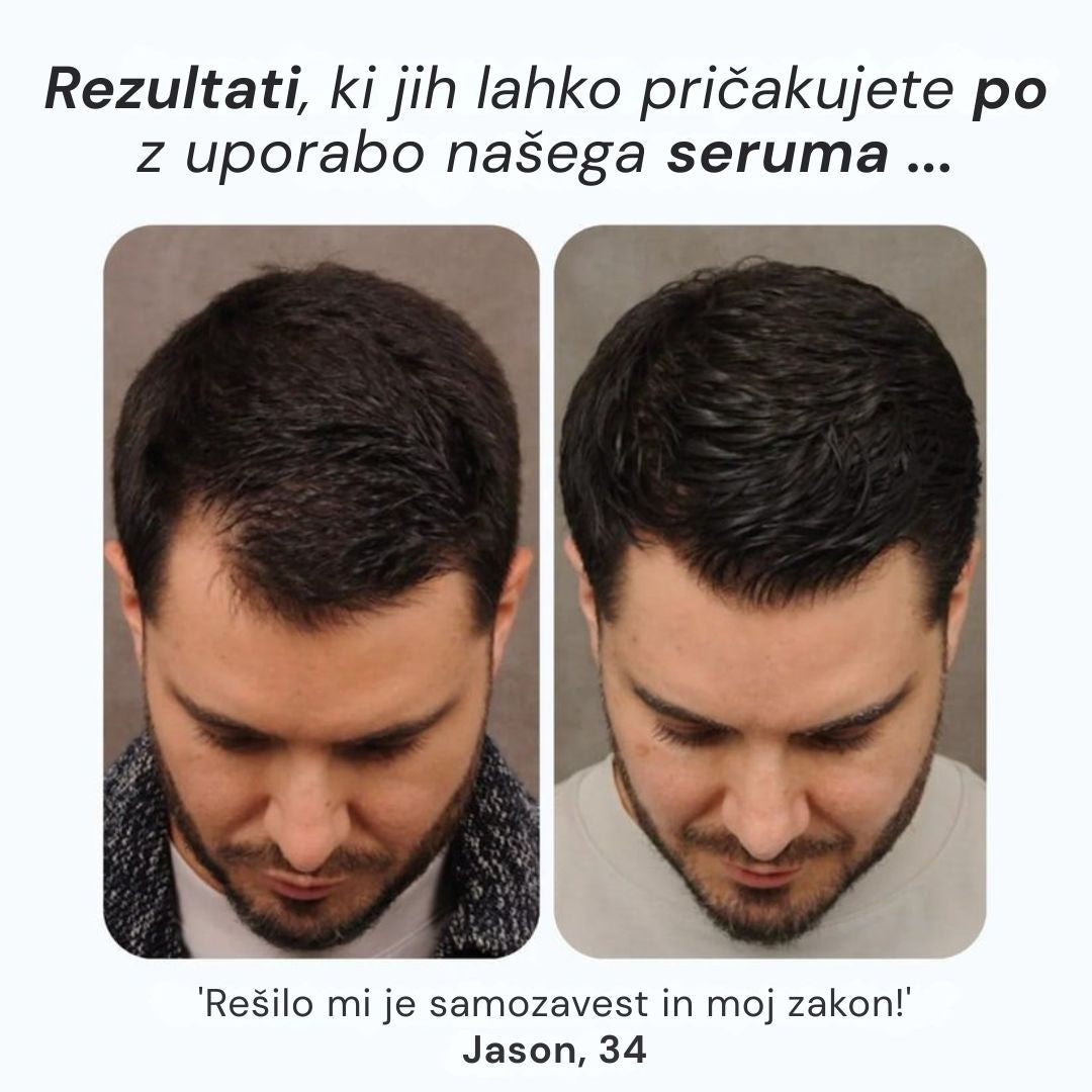 Daynava™ Roll-On za rast las