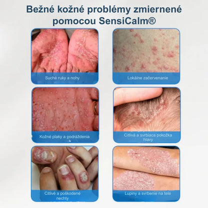 Upokojujúci krém na pokožku hlavy a kožu
