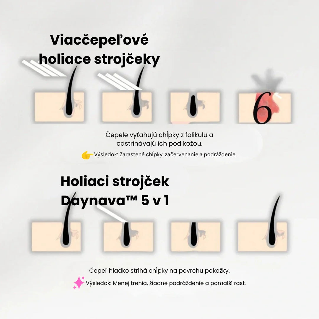 Daynava™ 5v1 Elektrický Holiaci Strojček