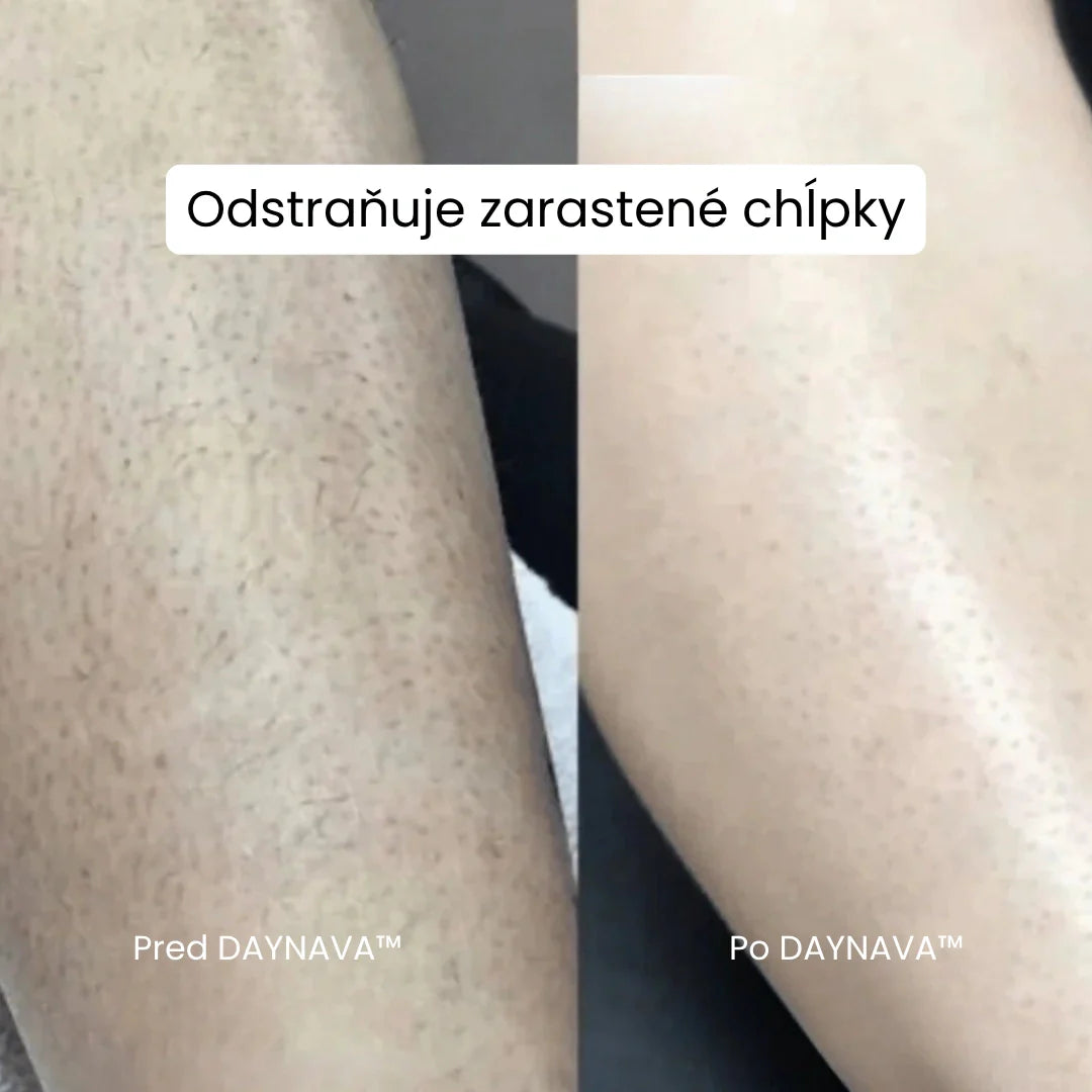 Daynava™ 5v1 Elektrický Holiaci Strojček