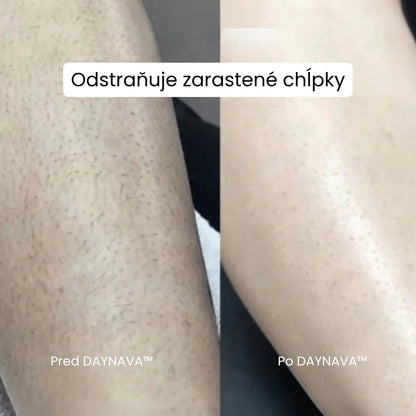 Daynava™ 5v1 Elektrický Holiaci Strojček