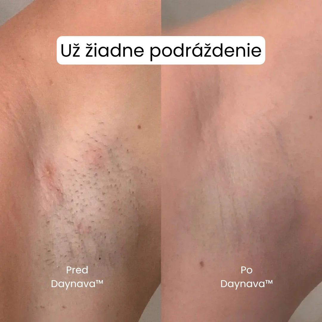 Daynava™ 5v1 Elektrický Holiaci Strojček