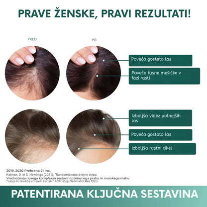 Vitamini z biotinom za rast las