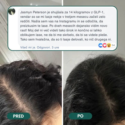 Vitamini z biotinom za rast las