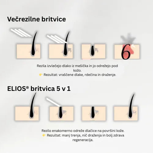 Daynava™ 5 v 1 Električni Brivnik (SL)
